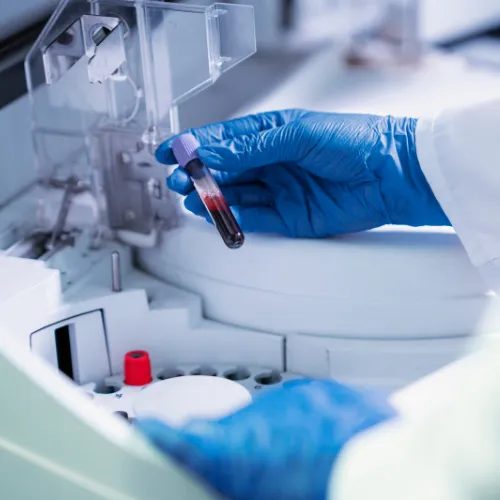 Lab Tests
